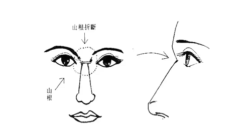脸上的山根在哪 山根在哪个部位图解